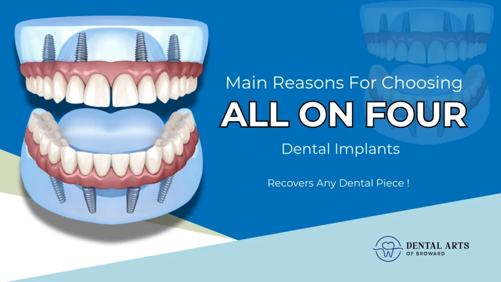 All-on-4 Dental Implants